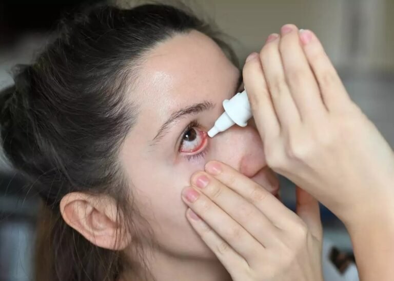 Eye care essentials for the Rainy season: Expert tips