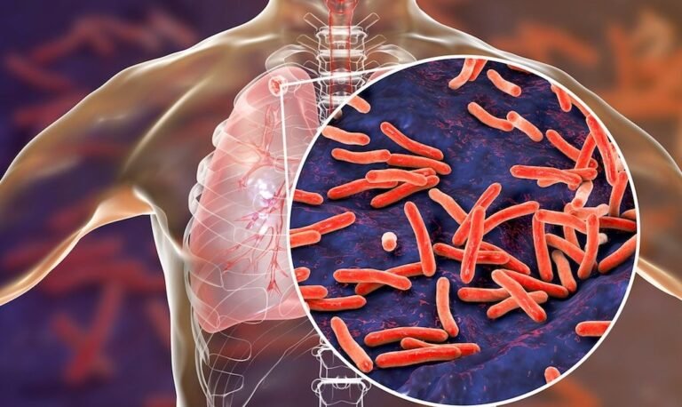 Since January 2024, 147 Mizoram residents have lost their lives to tuberculosis