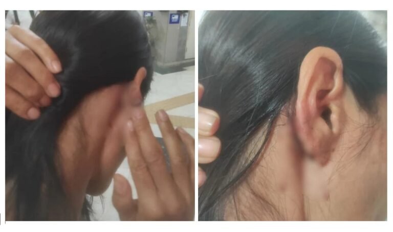 Four juveniles held in Delhi assault case involving Manipuri woman